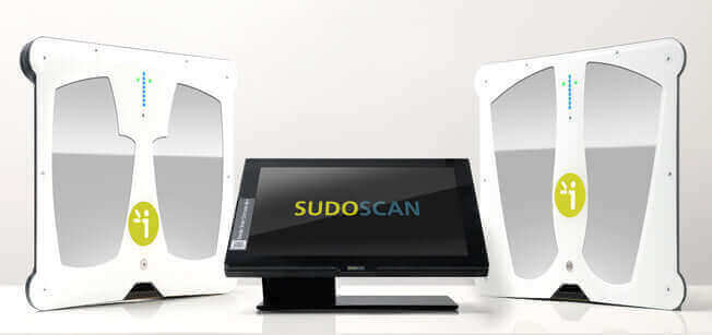  SUDOSCAN: The Cutting-Edge Machine Revolutionizing Neuropathy Diagnosis